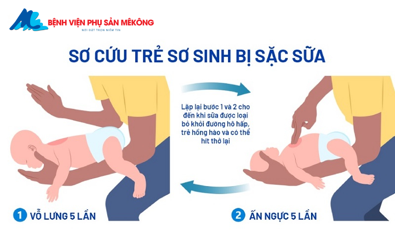 Cách cấp cứu trẻ sặc sữa