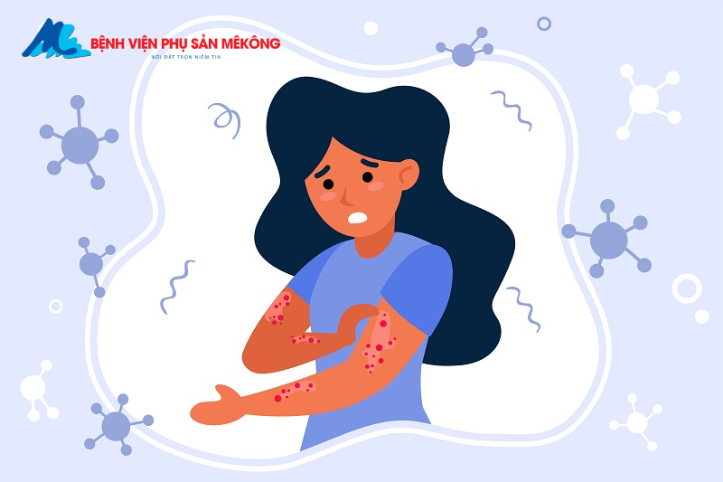 Vắc xin sởi quai bị rubella