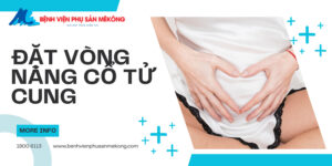 vòng nâng cổ tử cung