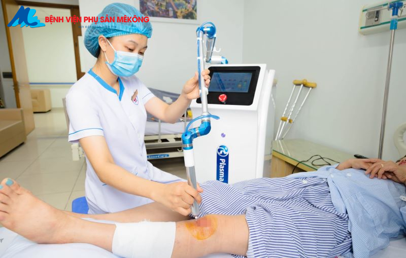 chiếu tia plasma sau sinh