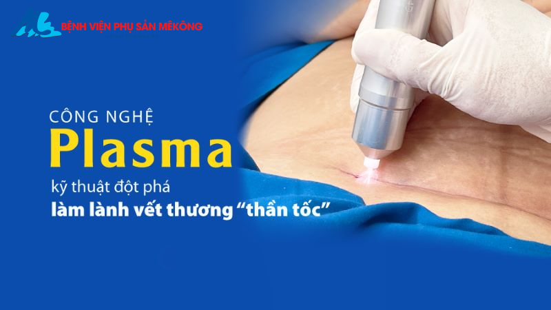 chiếu tia plasma sau sinh