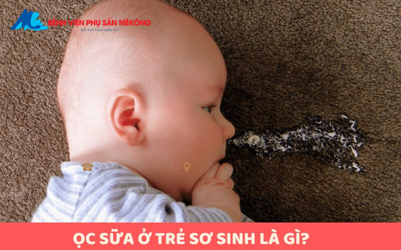 mẹo trị ọc sữa cho trẻ sơ sinh